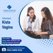 Menangani Kista Vagina di Klinik