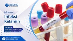 Infeksi kelamin